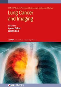 Cover image for Lung Cancer and Imaging