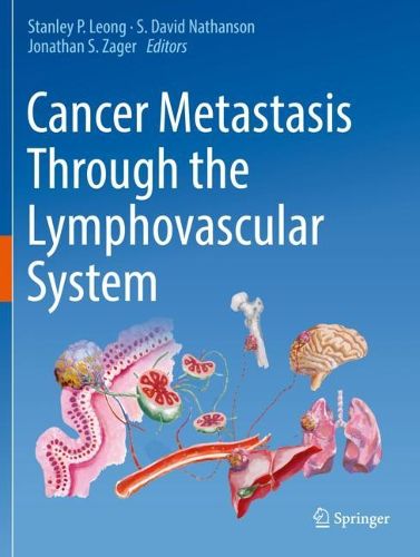 Cover image for Cancer Metastasis Through the Lymphovascular System