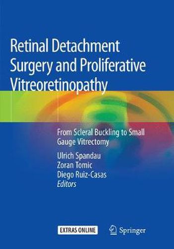 Cover image for Retinal Detachment Surgery and Proliferative Vitreoretinopathy: From Scleral Buckling to  Small Gauge Vitrectomy