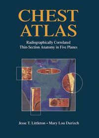 Cover image for Chest Atlas: Radiographically Correlated Thin-Section Anatomy in Five Planes