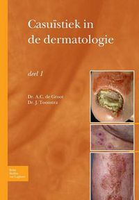 Cover image for Casuistiek in de Dermatologie - Deel I