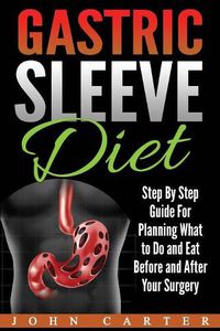 Cover image for Gastric Sleeve Diet: Step By Step Guide For Planning What to Do and Eat Before and After Your Surgery