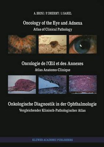 Cover image for Oncology of the Eye and Adnexa / Oncologie de l'OEil et des Annexes / Onkologische Diagnostik in der Ophthalmologie: Atlas of Clinical Pathology / Atlas Anatomo-Clinique / Vergleichender Klinisch-Pathologischer Atlas