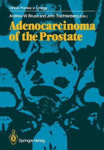 Cover image for Adenocarcinoma of the Prostate