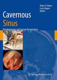 Cover image for Cavernous Sinus: Developments and Future Perspectives