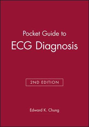 Cover image for Pocket Guide to ECG Diagnosis