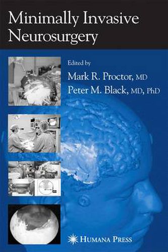 Cover image for Minimally Invasive Neurosurgery