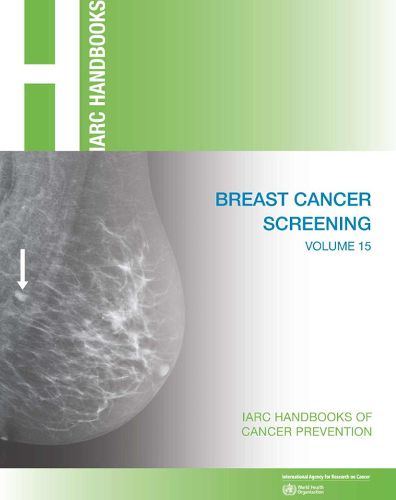 Cover image for Breast cancer screening