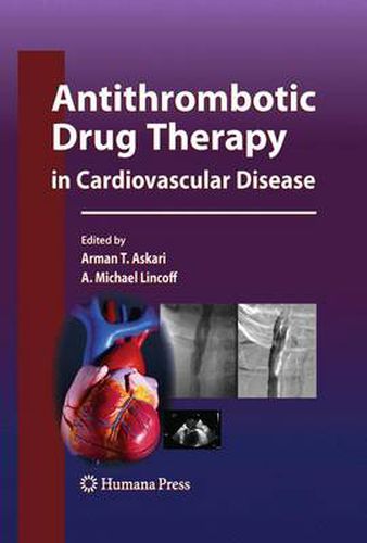 Cover image for Antithrombotic Drug Therapy in Cardiovascular Disease