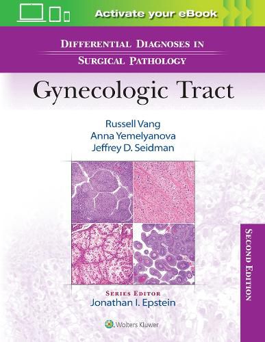 Cover image for Differential Diagnoses in Surgical Pathology: Gynecologic Tract