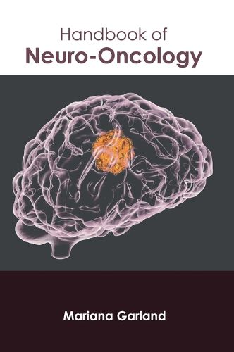 Cover image for Handbook of Neuro-Oncology