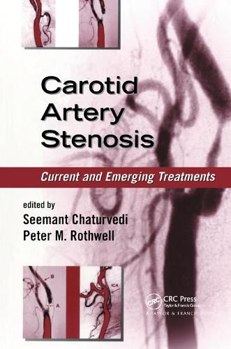 Cover image for Carotid Artery Stenosis: Current and Emerging Treatments