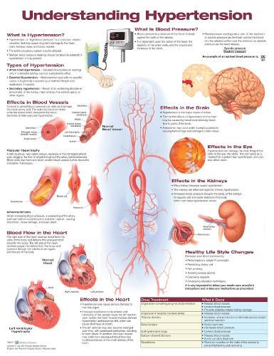 Cover image for Understanding Hypertension Anatomical Chart