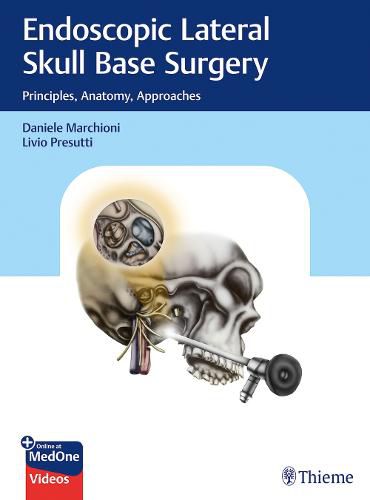 Cover image for Endoscopic Lateral Skull Base Surgery: Principles, Anatomy, Approaches