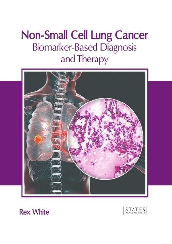 Cover image for Non-Small Cell Lung Cancer: Biomarker-Based Diagnosis and Therapy