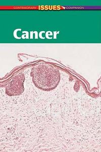 Cover image for Cancer