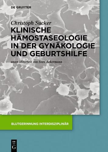 Cover image for Klinische Hamostaseologie in der Gynakologie und Geburtshilfe