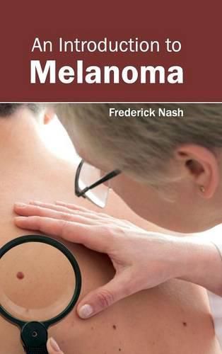 Cover image for Introduction to Melanoma