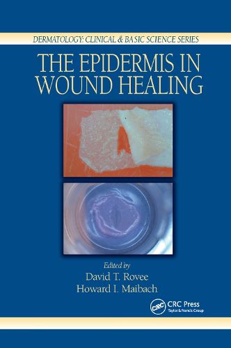 Cover image for The Epidermis in Wound Healing