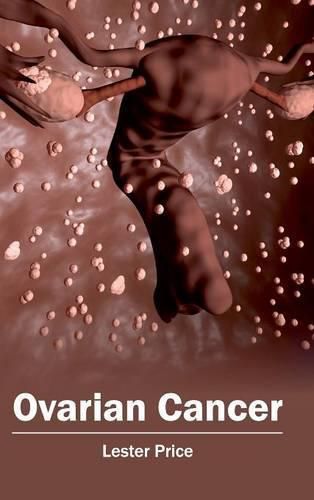 Cover image for Ovarian Cancer