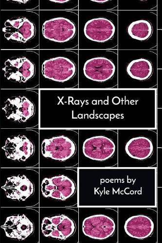 Cover image for X-Rays and Other Landscapes