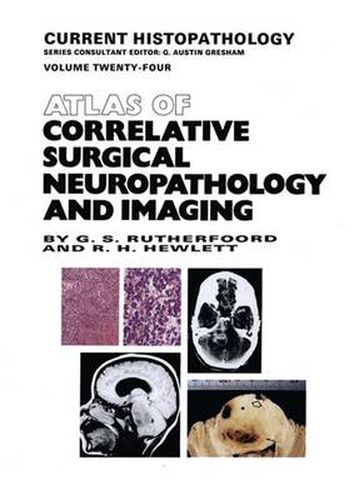 Cover image for Atlas of Correlative Surgical Neuropathology and Imaging