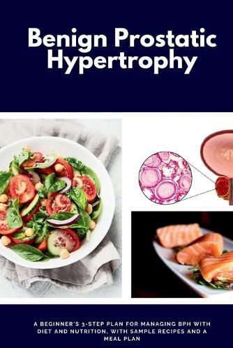 Cover image for Benign Prostatic Hypertrophy