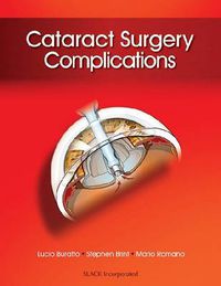 Cover image for Cataract Surgery Complications