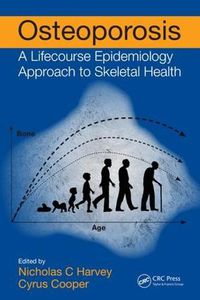 Cover image for Osteoporosis: A Lifecourse Epidemiology Approach to Skeletal Health