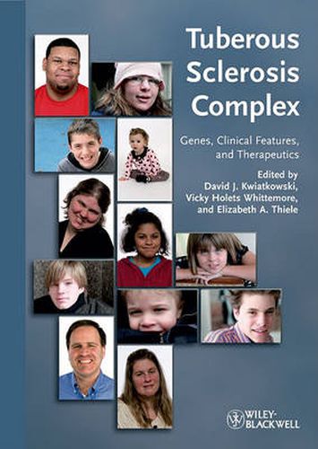 Cover image for Tuberous Sclerosis Complex: Genes, Clinical Features and Therapeutics