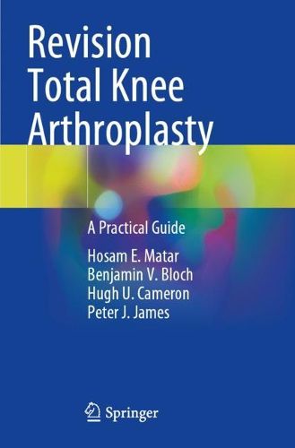 Cover image for Revision Total Knee Arthroplasty: A Practical Guide