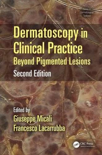 Cover image for Dermatoscopy in Clinical Practice: Beyond Pigmented Lesions