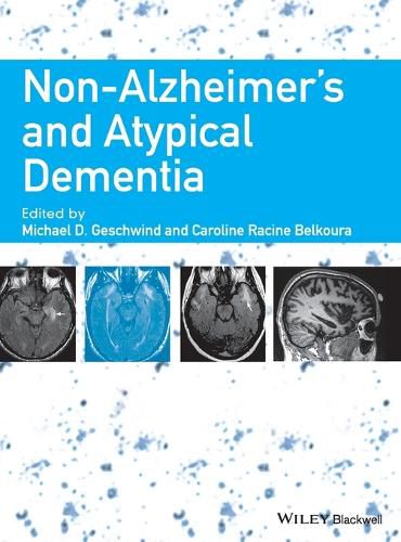 Cover image for Non-Alzheimer's and Atypical Dementia