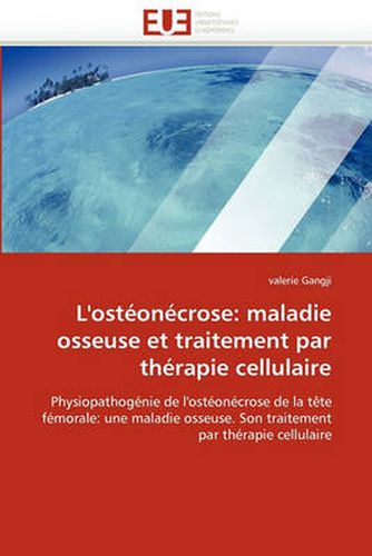 Cover image for L'Osteonecrose: Maladie Osseuse Et Traitement Par Therapie Cellulaire