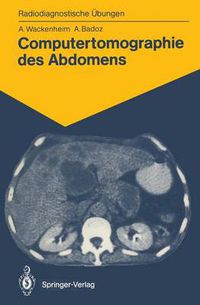 Cover image for Computertomographie des Abdomens