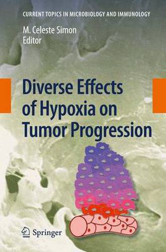 Cover image for Diverse Effects of Hypoxia on Tumor Progression