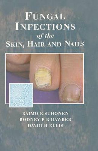 Cover image for Fungal Infections of the Skin and Nails