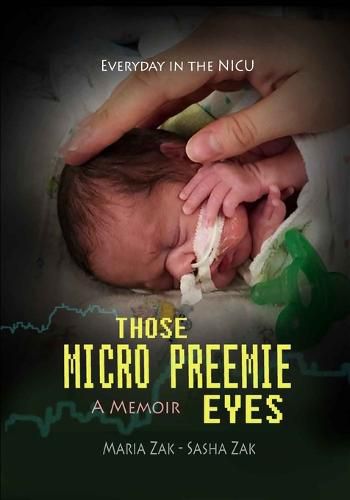 Cover image for Those Micro Preemie Eyes