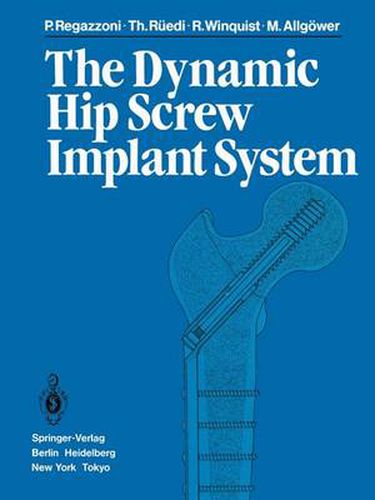 Cover image for The Dynamic Hip Screw Implant System