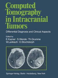 Cover image for Computed Tomography in Intracranial Tumors: Differential Diagnosis and Clinical Aspects