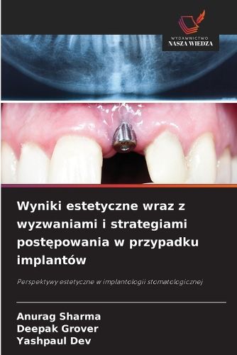 Cover image for Wyniki estetyczne wraz z wyzwaniami i strategiami postępowania w przypadku implantow