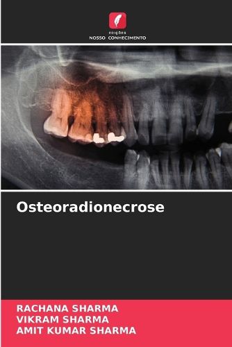 Cover image for Osteoradionecrose