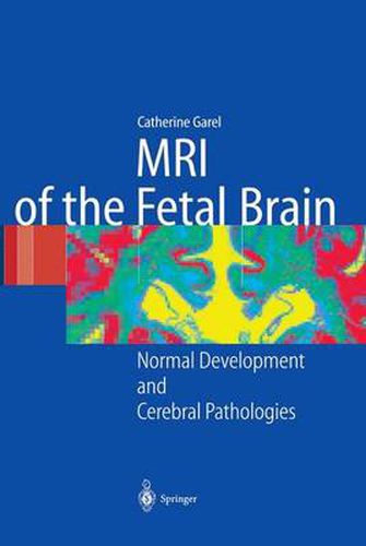 Cover image for MRI of the Fetal Brain: Normal Development and Cerebral Pathologies