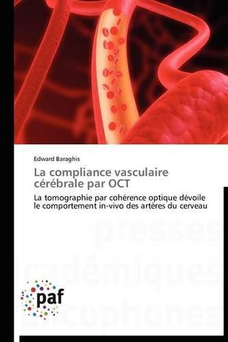 Cover image for La Compliance Vasculaire Cerebrale Par Oct