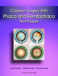 Cover image for Cataract Surgery with Phaco and Femtophaco Techniques