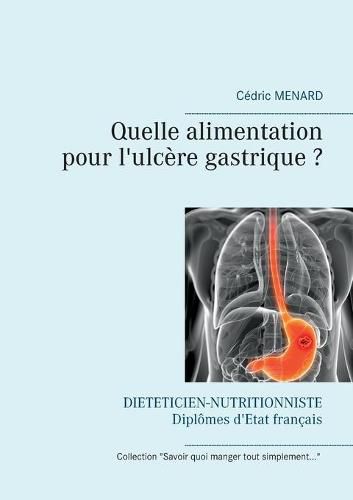 Quelle alimentation pour l'ulcere gastrique ?