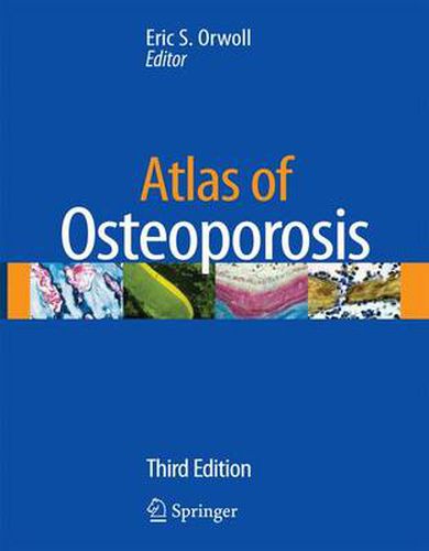 Cover image for Atlas of Osteoporosis