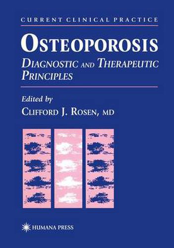 Cover image for Osteoporosis: Diagnostic and Therapeutic Principles