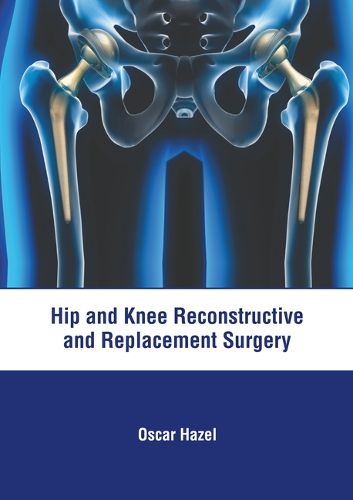 Cover image for Hip and Knee Reconstructive and Replacement Surgery
