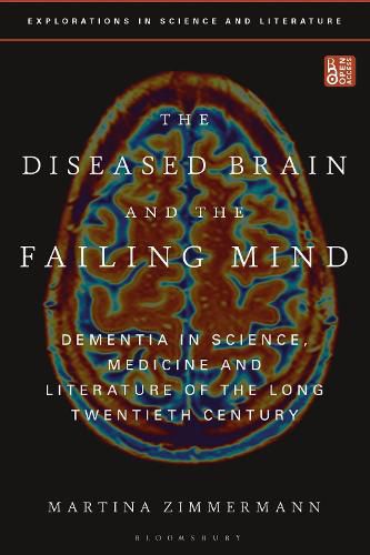 Cover image for The Diseased Brain and the Failing Mind: Dementia in Science, Medicine and Literature of the Long Twentieth Century